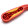 cholesterol