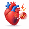 Heart attack