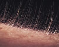 bristle