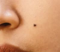 mole