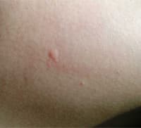 welt